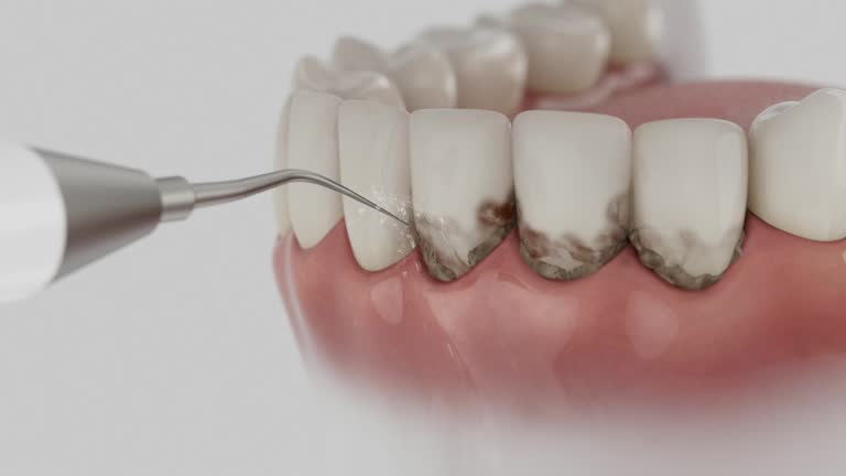 Reliable Dental Implants contractor in Whitfield, PA by Smile Center Dentistry